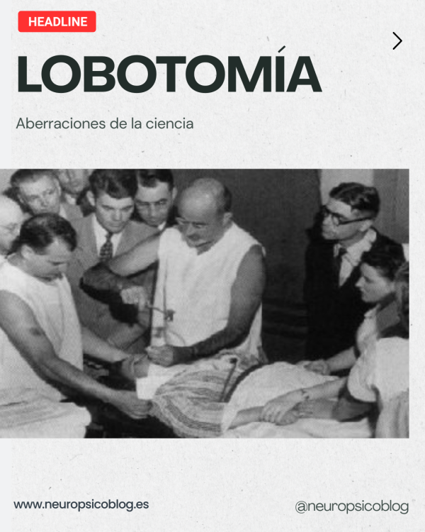 Historia de la lobotomía
